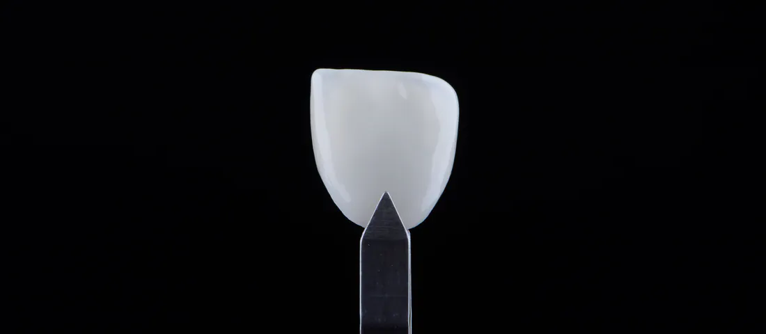 Tooth contouring image